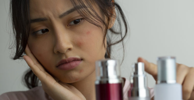 skin purging vs acne breakout featured