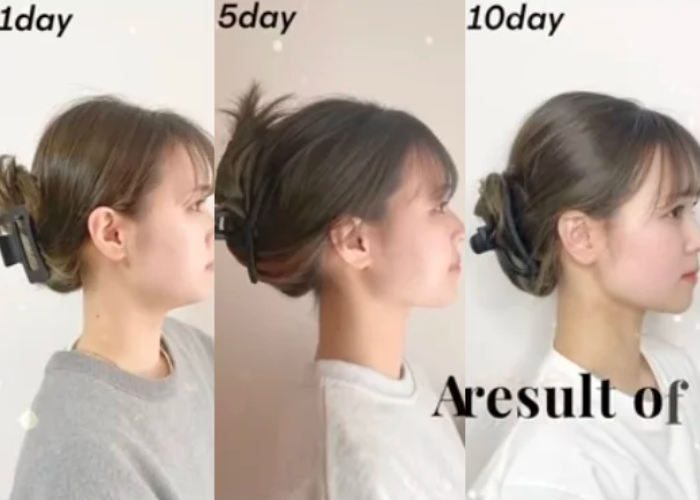 Picture of How to reduce double chin and achieve that celebrity jawline